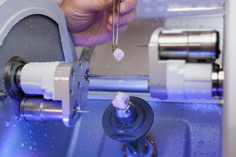 Labor Herstellung einer Zahnkrone Herstellung Zahnersatz/Krone aus Keramik in einem Labor mittels CAD/CAM System